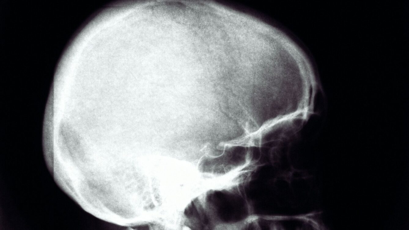 Photo by Risto Kokkonen/unsplash