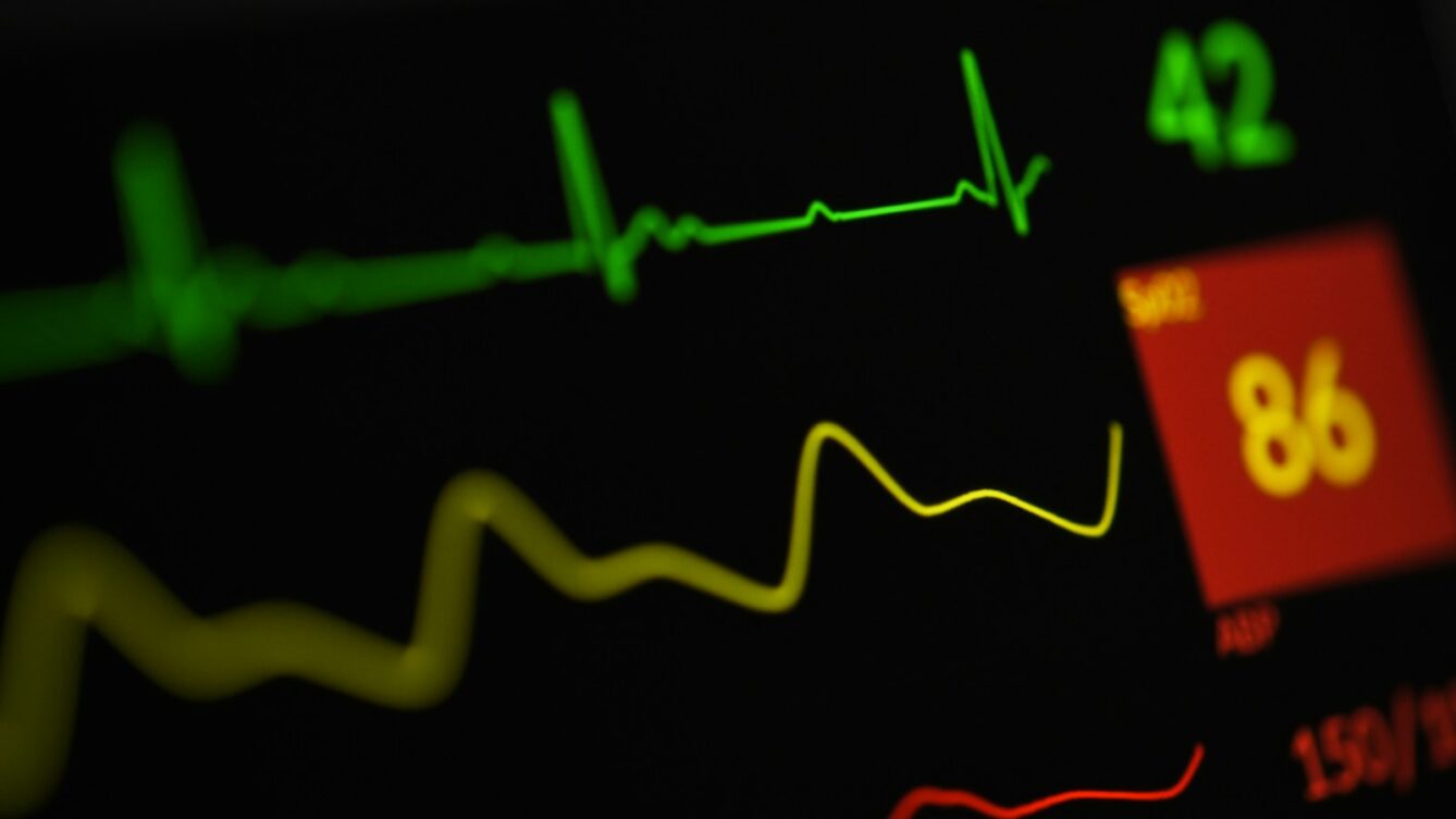 Ekran z wykresem ekg, Joshua Chehov/Unsplash