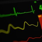 Ekran z wykresem ekg, Joshua Chehov/Unsplash