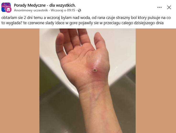 Post na FB - objawy zakażenia