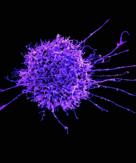 Naukowcy z Bonn cofnęli zegar molekularny komórek 80-latka o ponad 60 lat. Nowa metoda może pomóc w badaniach nad starzeniem i chorobą Alzheimera. fot: National Institute of Allergy and Infectious Diseases