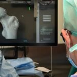 Jak wygląda operacja endoprotezy biodra? Prof. Paweł Łęgosz tłumaczy, jak wszczepia się sztuczny staw, w czym pomaga robot i kiedy pacjent zaczyna chodzić. WUM - mat. pras.