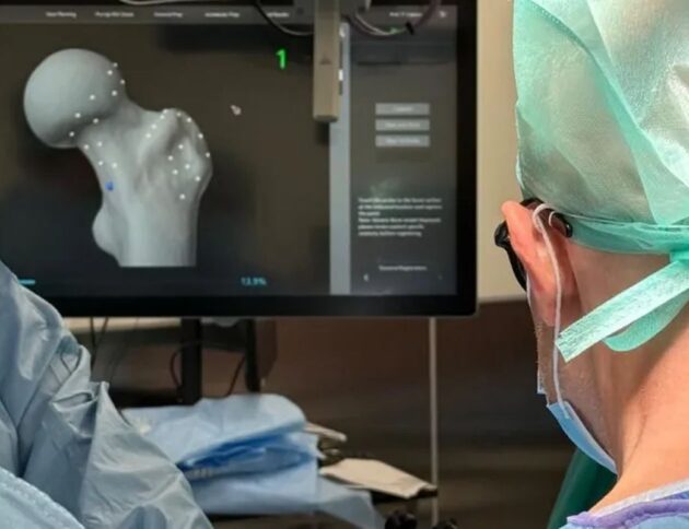 Jak wygląda operacja endoprotezy biodra? Prof. Paweł Łęgosz tłumaczy, jak wszczepia się sztuczny staw, w czym pomaga robot i kiedy pacjent zaczyna chodzić. WUM - mat. pras.