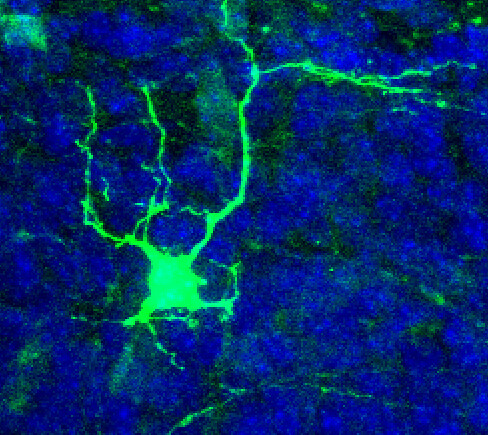 Drukowana w 3D rurka GrooveNeuroTube, opracowana w Centrum Zaawansowanych Technologii UAM, odtwarza warunki sprzyjające regeneracji przerwanych nerwów.